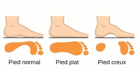 pieds-creux_-min.jpg